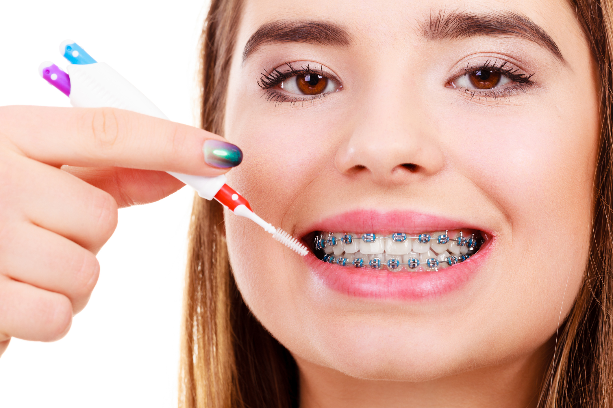 Caring For Braces Guide To A Healthy And Beautiful Smile Dentist In